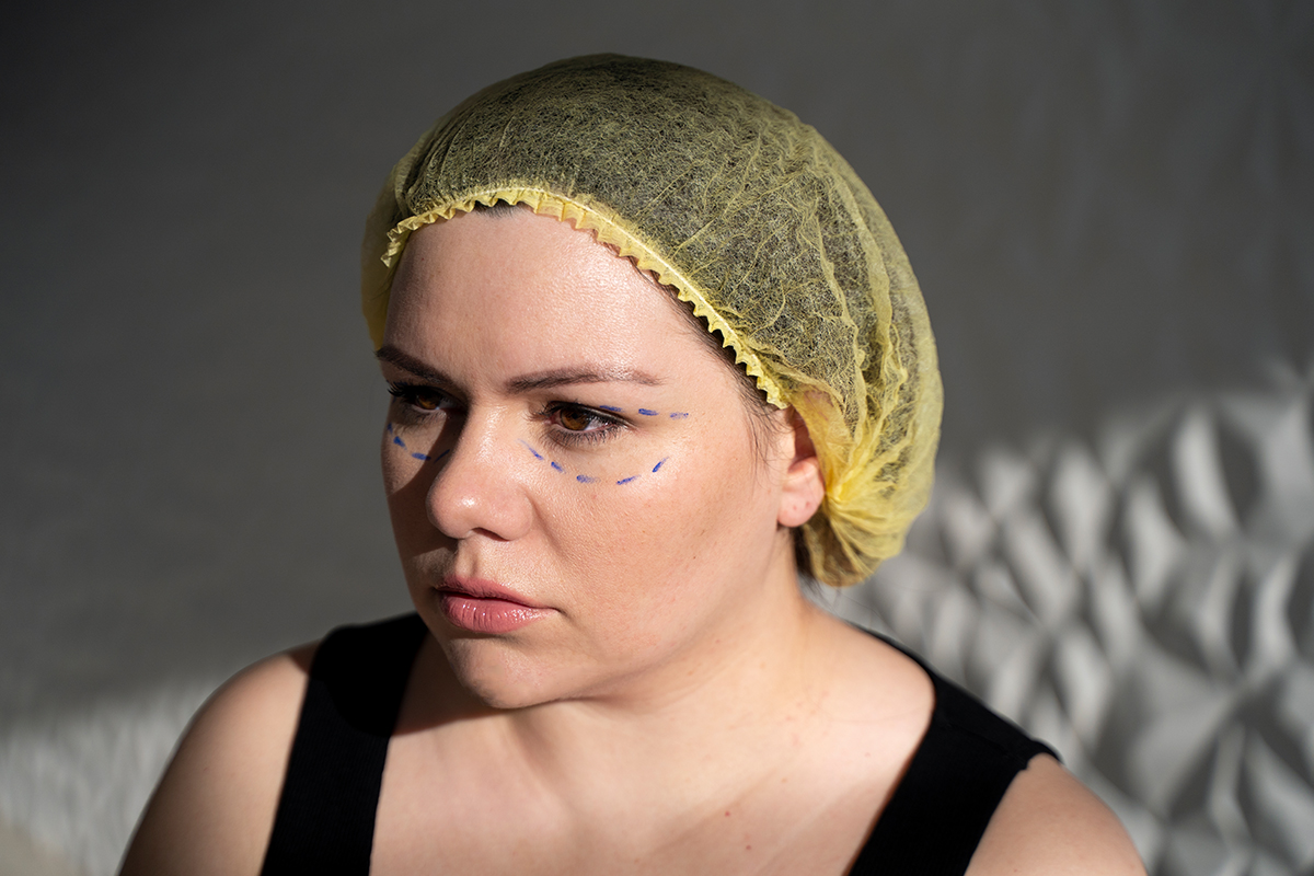 Orbital Bone Surgery Cost