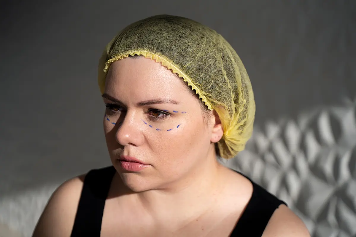 Orbital Bone Surgery Cost